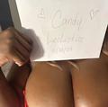 Candy is Female Escorts. | Barrie | Ontario | Canada | escortsaffair.com 