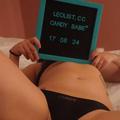 Candybabe is Female Escorts. | Niagara | Ontario | Canada | escortsaffair.com 