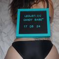 Candybabe is Female Escorts. | Niagara | Ontario | Canada | escortsaffair.com 