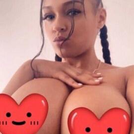  is Female Escorts. | Sacramento | California | United States | escortsaffair.com 